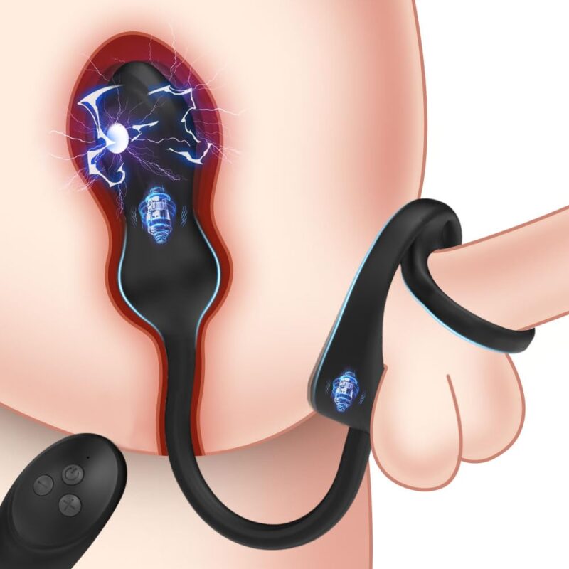 Black electroshock anal vibrator with a textured head and wireless remote. Black electroshock anal vibrator with a textured head and wireless remote.